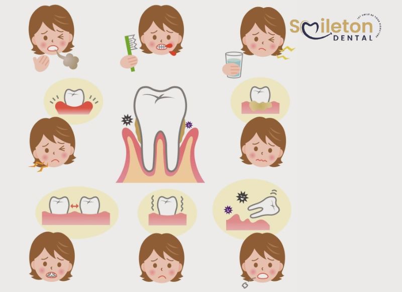 Gum Treatment in Hyderabad